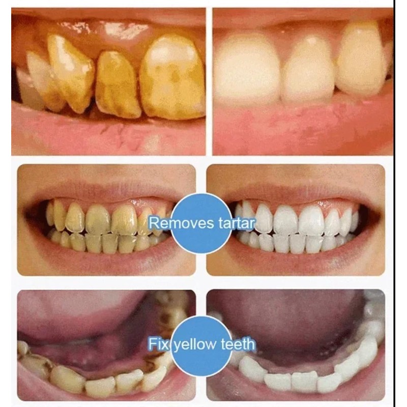 7.5 nHAP Hydroxyapatite Toothpaste - Nano Hydroxyapatite Whiteing Teeth |