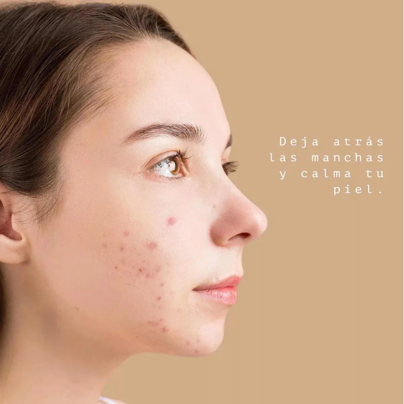 Despigmentante Facial Niacinamida 10% Normal Día/noche