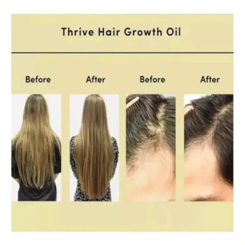Aceite Esencial Para El Cuidado Del Cabello Con Plantas De
