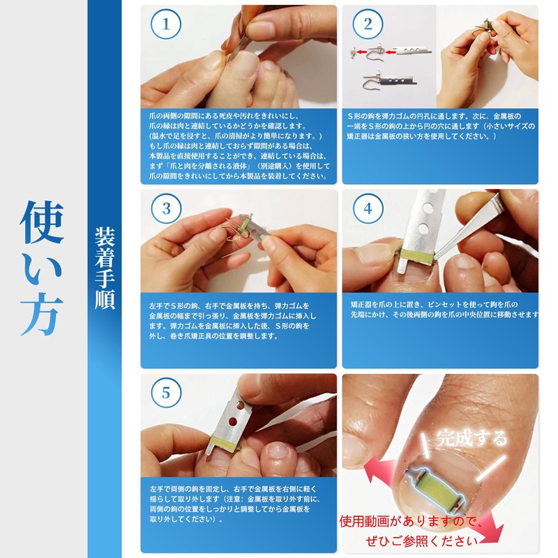巻き爪器具 2個入り 巻き爪 まきづめ 陥入爪 まきずめ 巻爪 器具 オリジナル説明書付属 (16-18mm)