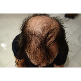 Finally Hair Keratin Hair Building Fibers for Hair Thickening Fiber Hair Loss Concealer. (Dark Grey & Pepper)