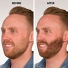 Infinity Hair Fibers, Keratin Hair Loss Concealer, Women and Men,