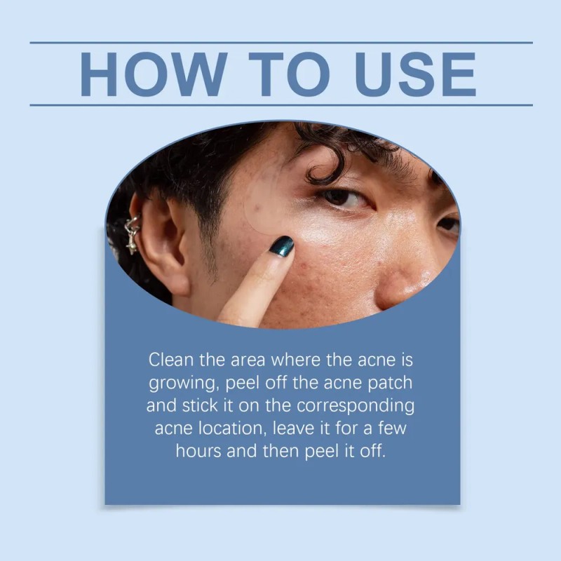 El Parche Ouhoe Moon Acne Repara El Acné De La