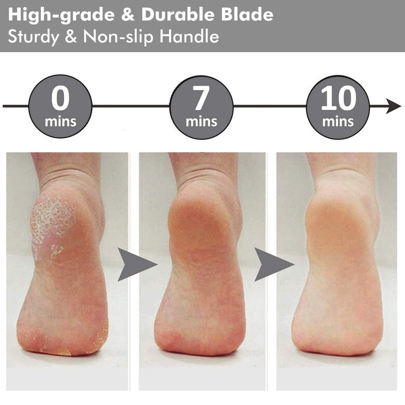 ELEPHANTBOAT® Stainless Steel Rasp Callus File Blade Foot Care(Grey)