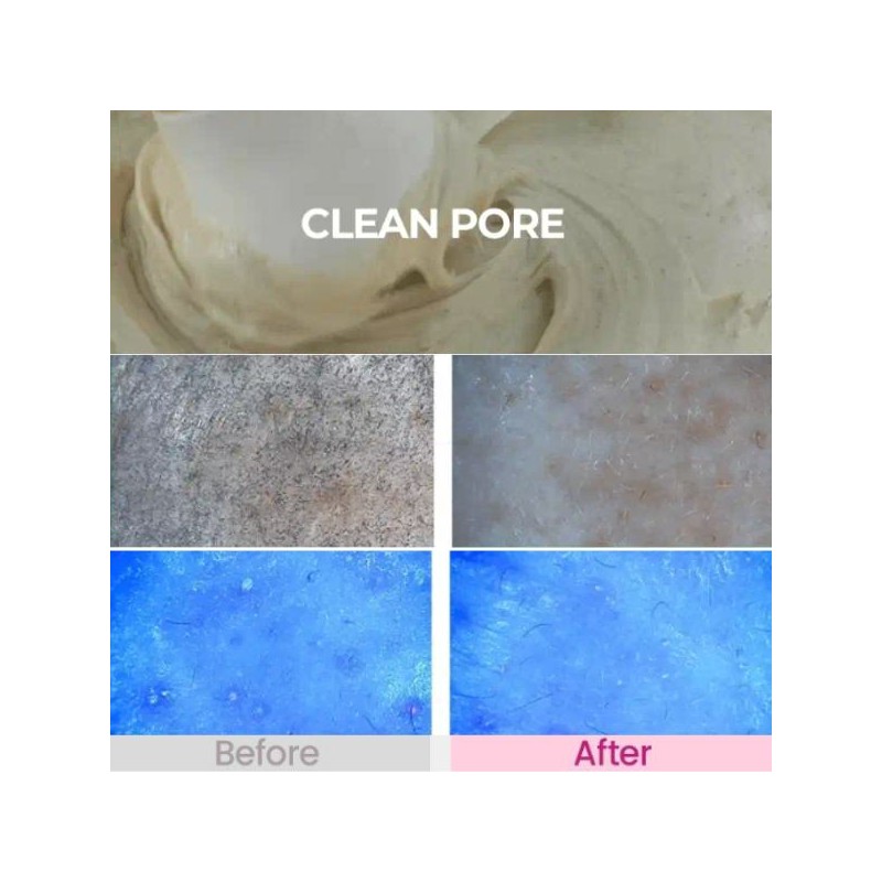 DEWDAP Pack Cleanser 150ml [Cicatea-Pore/Dewtox-Lift], Color:EYTAIL