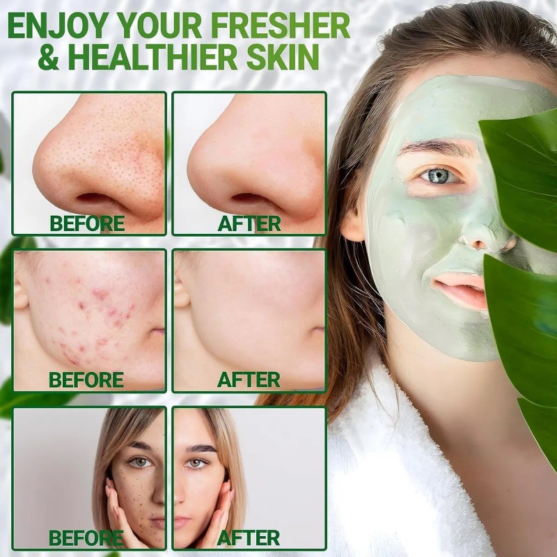 🔥 Mascarilla mask stick green tea anti acne limpieza profunda