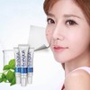 Bioaqua Acne Cream Cicatrices Poros Control De Grasa 1 Pzs
