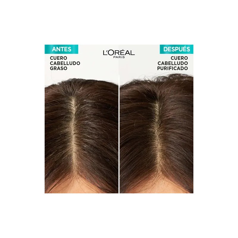 Shampoo Elvive Hialurónico Pure x370ml