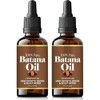 Aceite De Batana, Aceite De Batana Para El Cabello, Capilar