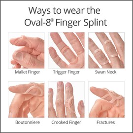 Oval-8 Finger Splints, Size 14
