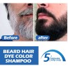Champú Para Hombres Para Pelo De Oso Teñido, Color Natural