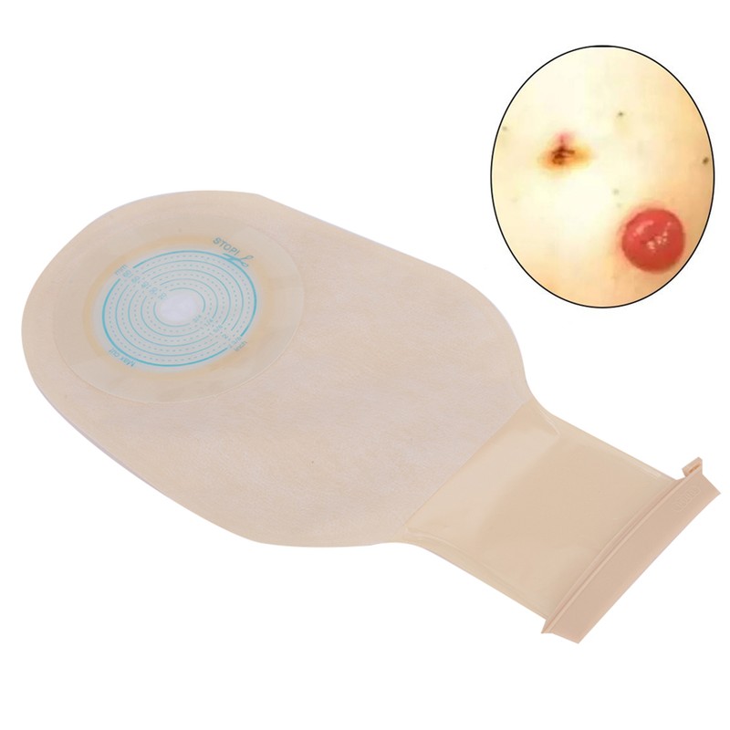 10pcs Disposable Colostomy Bag Soft Skin Friendly Colostomy Pouch Bag(Open