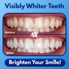 Dentasheen Teeth Whitening Powder – Dentist-Approved Tooth Whitener – Enamel-Safe,