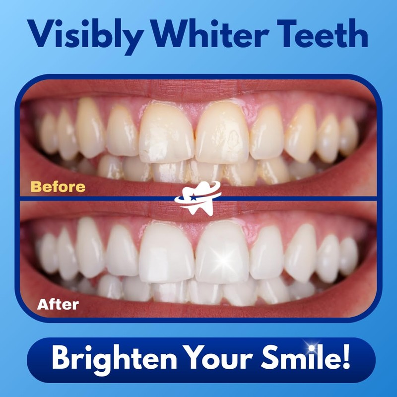 Dentasheen Teeth Whitening Powder – Dentist-Approved Tooth Whitener – Enamel-Safe,
