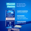 Noxzema Acne Treatment Bundle - Clear Blemish Patches & Pads