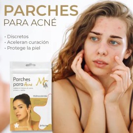 Parches Estrella Anti Acné Mc Life Hidrocoloidal 240 Pza Todo Tipo De Piel Día/noche