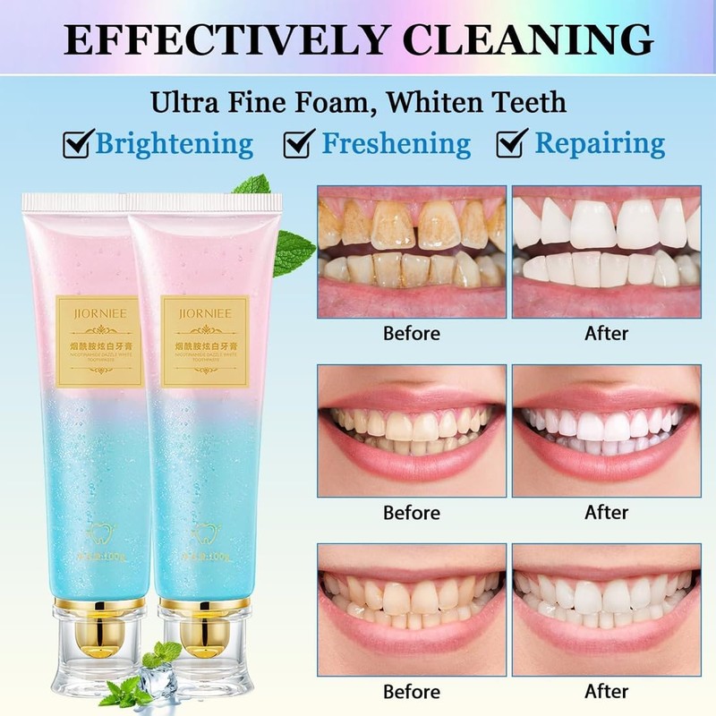 2 Packs Niacinamide Whitening Toothpaste, Niacinamide Intensive Whitening Toothpaste, Nicotinamide