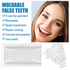 Dental Temporary Tooth Cap Crown Veneers Front Back Anterior and