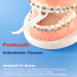 Fremouth Individually Wrapped Orthodontic Flossers for Braces - Ortho Dental Floss Picks, 75 Count (Pack of 1)