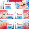 G.CATACC Dental Tools, Dental Pick Teeth Cleaning Tools Hygiene Kit,