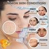 10PCS Face Mask Set,Moisturizing Facial Sheet Mask,Hydrating Face Mask Skin