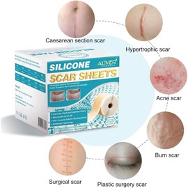 Cinta de silicona profesional para cicatrices en rollo (4 cm x 3 m) – Tiras avanzadas reutilizables para eliminar cicatrices de cesárea, cirugía, quemaduras, queloides y acné. Rollo de siliocona para cicatrices y marcas.