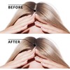 Lanthome Hair Growth Ginger Hair Nutrient Serum for Thinning Hair,
