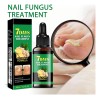 Lápiz Líquido Reparador De Uñas, Tratamiento Para Hongos En