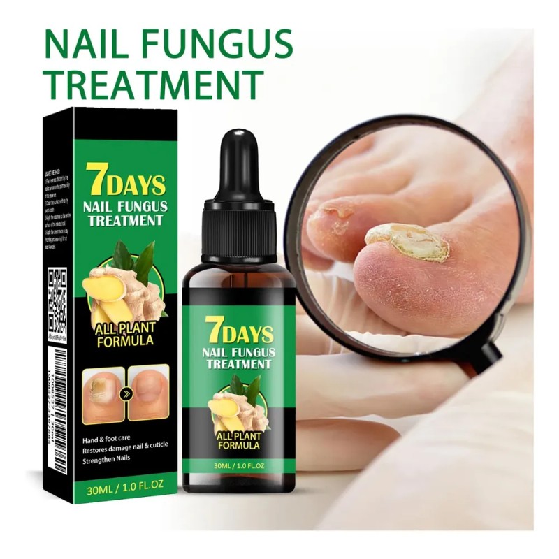 Lápiz Líquido Reparador De Uñas, Tratamiento Para Hongos En