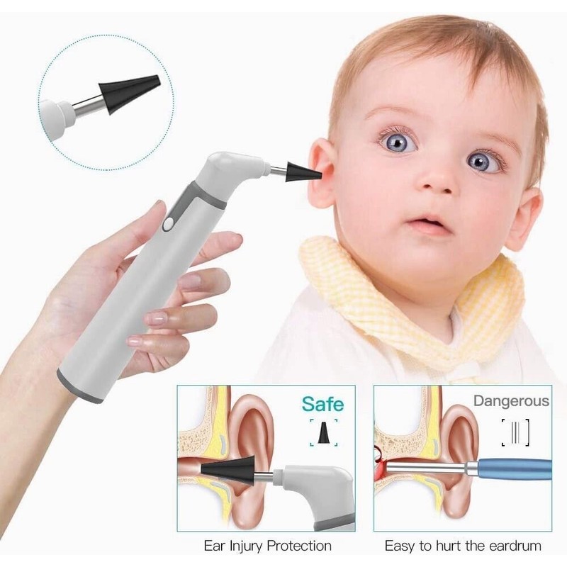 ScopeAround Wireless Otoscope Ear Camera with Dual View, 3.9Mm 720PHD