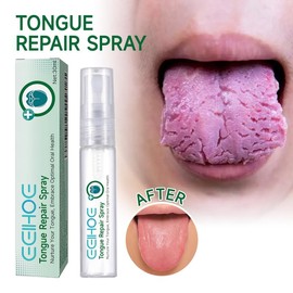 EELHOE Tongue Repair Spray Repair White tongue coating to relieve dry, cracked and swollen tongue Oral care spray - Color: 2