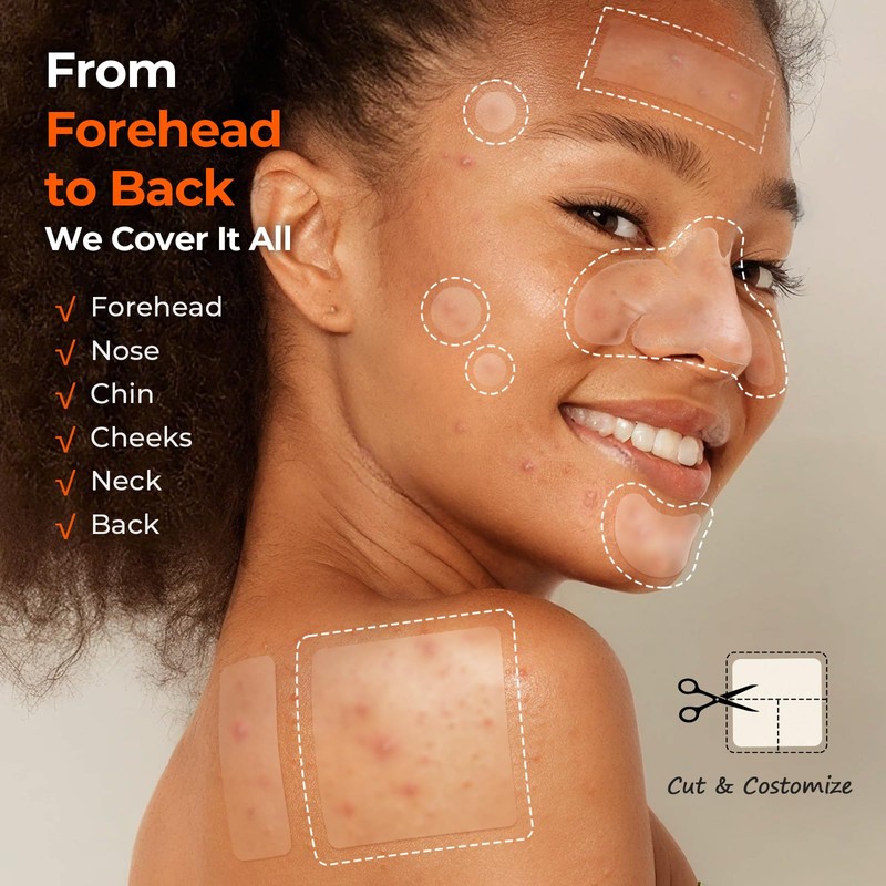 TKTK Pimple Patches for Face, 6 Sizes Hydrocolloid Acne Patch