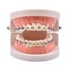 Chargenyang 1040pcs Orthodontic Ligature Ties Multi-Color Orthodontic Elastomeric O-Rings Braces