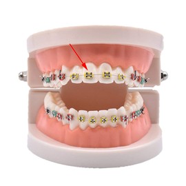 Chargenyang 1040pcs Orthodontic Ligature Ties Multi-Color Orthodontic Elastomeric O-Rings Braces Rubber Bands (Multicolor)