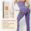 KOAHDE The Butt And Thigh Area,Butt Pimple Removing Cream,Reduce Acne