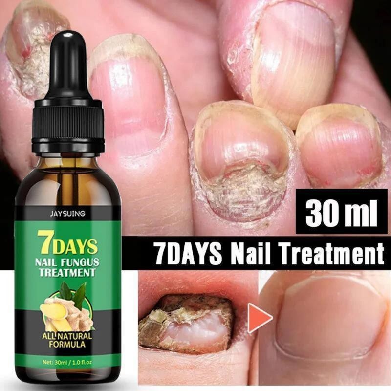 JAYSUING Ginger Nail Care Liquid, Nail Nutrients, Repairs Damaged and