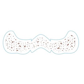 Diesetsr Face Makeup Patches - Glitter Freckles, Easy to Create Charming Freckles, Suitable for Daily and Party use-Five Optional Designs