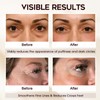Cooling Brightening Roller Ball, containing caffeine, niacinamide, and triple collagen