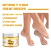 Crema For Pies For Talones Y Pies Secos Y Agrietados