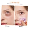WOONEKY Reusable Eye Gel Pack Heart Shape for Eye Fatigue