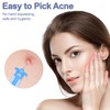 50 Pack Disposable Acne Pimple Popper Needles and 72 Dots
