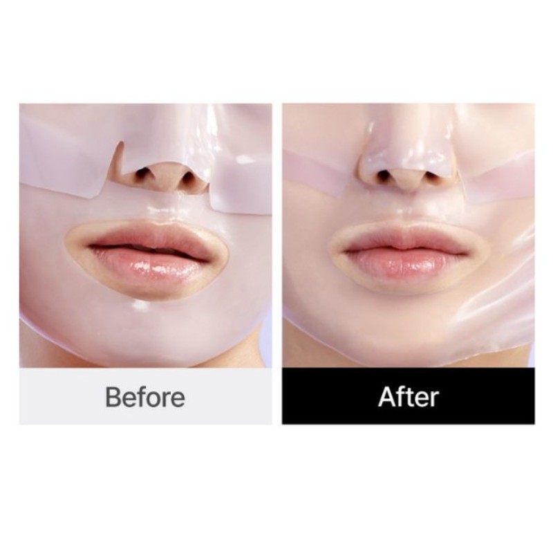 MEDIANSWER Calming Collagen Nano Shot Mask 37g*5ea