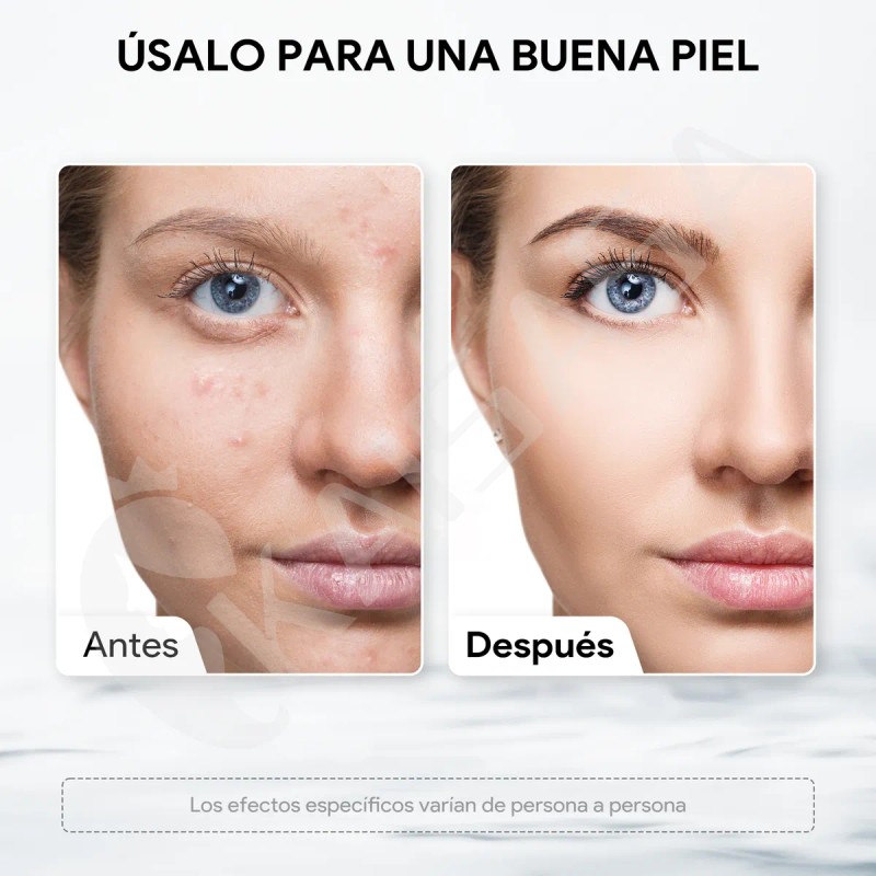 Kit Soluciones Hydrafacial As1 Sa2 Ao3 Hydradermabrasion