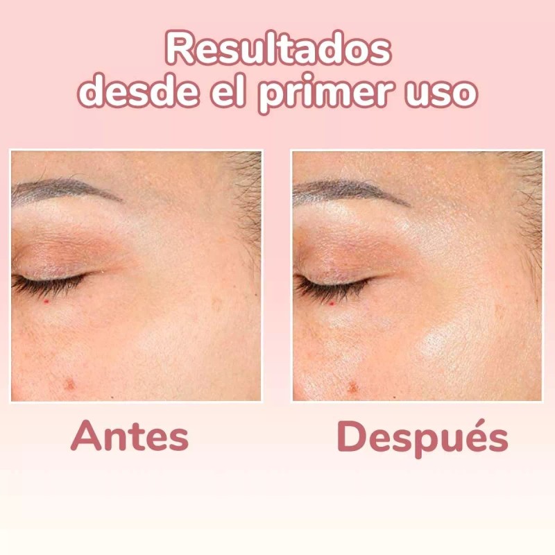 Acala Skin Serum 4 En 1 - Vitamina C +