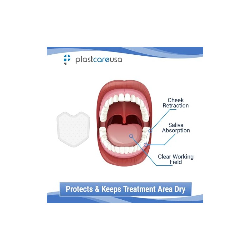 200 Dental Dry Corners, Disposable Saliva Control Cheek Protection Pads