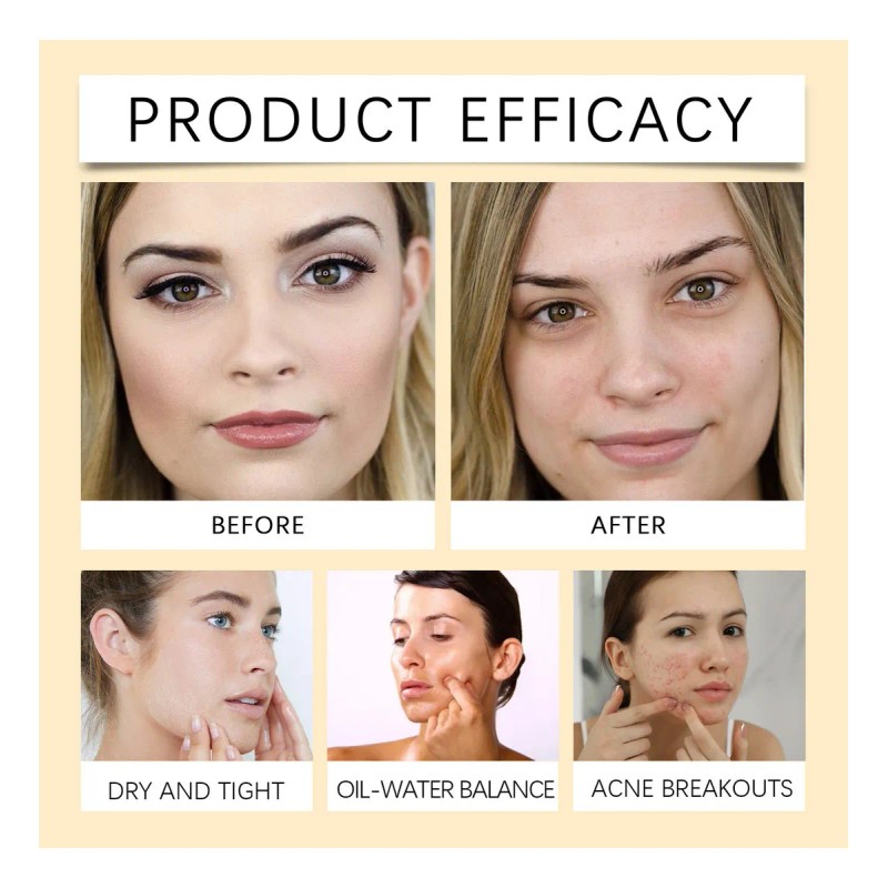 Aceite Limpiador Ligero De Centella Asiatica, Refrescante Y