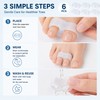 6-Piece Silicone Toe Separators for Daily Comfort – Soft Washable