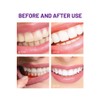 Mulberry Toothpaste Herbal Extracts Aloe Chamomile Sensitive Tooth Care Relieve