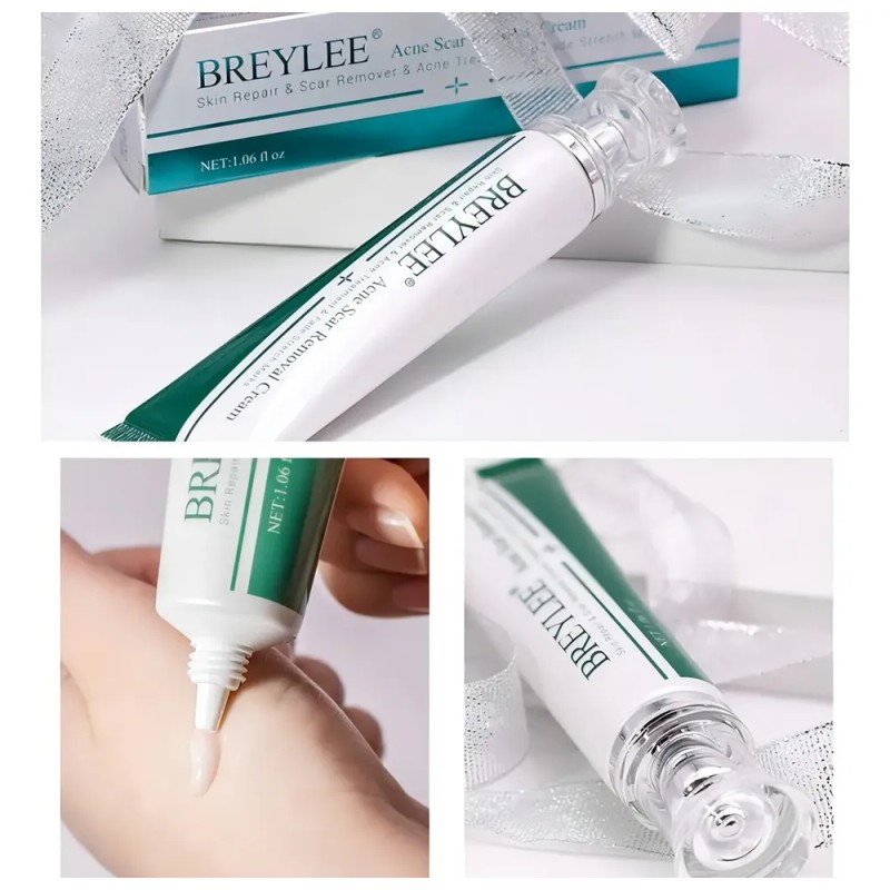 Breylee | Crema Elimina Estrías, Cicatrices, Acné Y Manchas