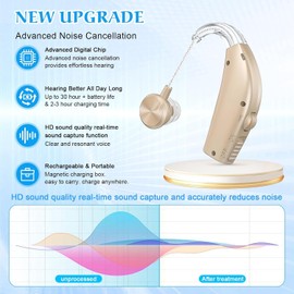 Rechargeable Hearing Aids for Seniors, Hearing Loss Hearing Amplifiers, Digital Hearing Aid with Noise Cancelling, Volume Control with Portable Charging Case (White)